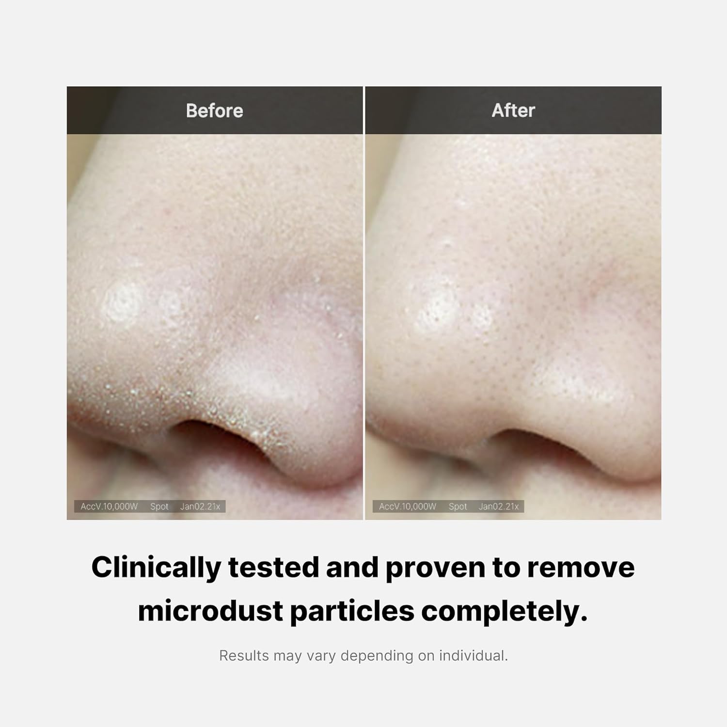 714bbiKocQL._SL1500_ medicube Zero Foam Cleanser for Sensitive Skin - Sebum Control, Moisture Balance, and Pore Minimization Korean Skincare