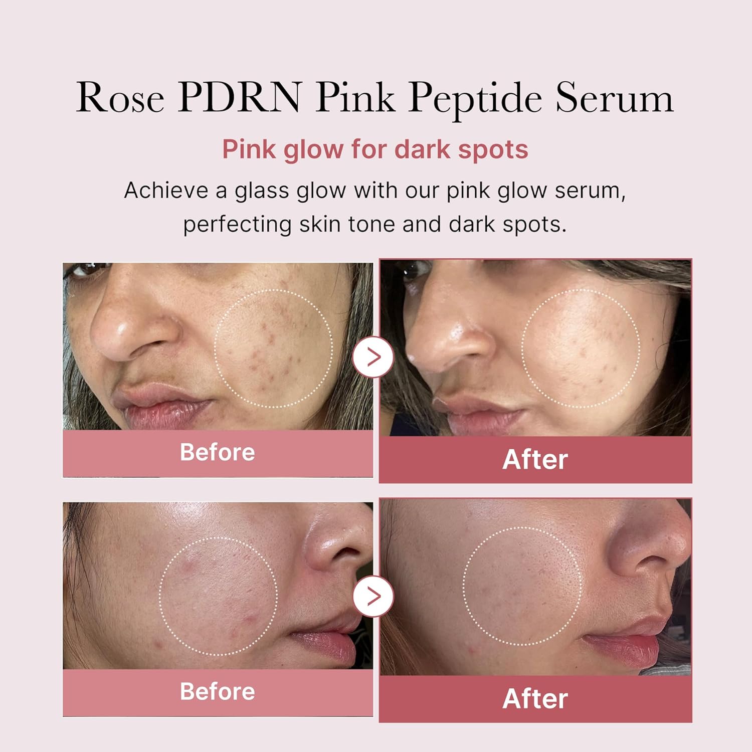 71VWOE~1 medicube PDRN Pink Peptide Serum, Pink glow serum, Peptide, Niacinamide, Hydrating & Moisturizing & Firming, Uneven Skin Tone, Korean Skincare 1.01 fl.oz. (1.01 fl.oz., Rose PDRN (Vegan))