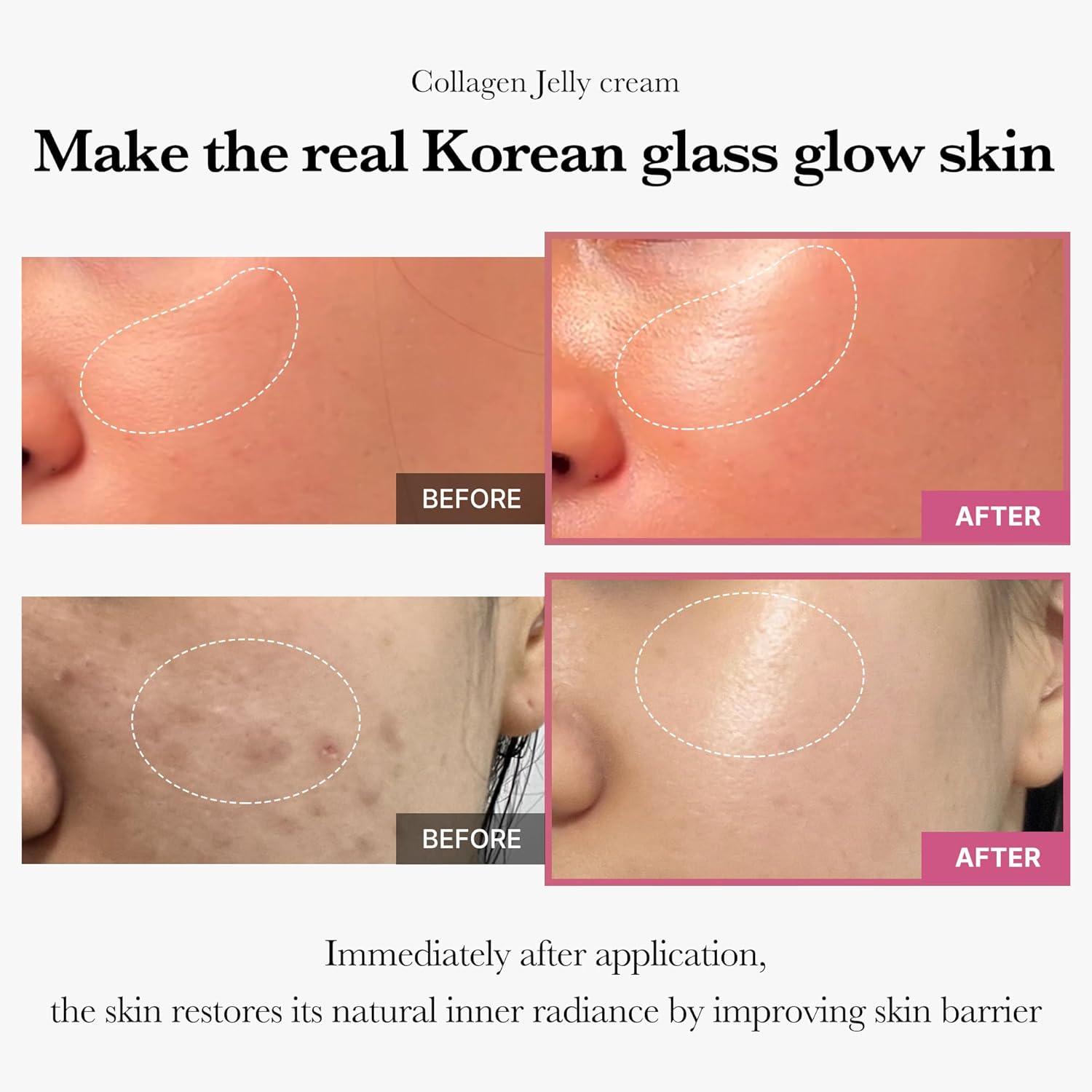 71_TTY~1 medicube Collagen Jelly Cream- Niacinamide & Freeze-Dried Hydrolyzed Collagen - Boosts skin's barrier hydration and gives 24h Glow & Lifted Look - No artificial color, Korean skincare (3.71 fl.oz.)